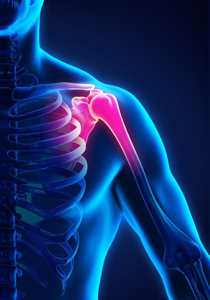 Shoulder Pain
